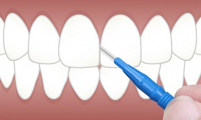 Jak správně pečovat o zuby?