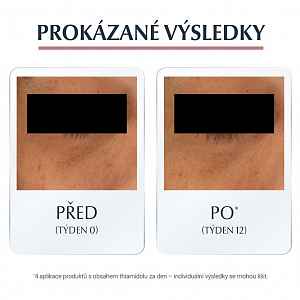 EUCERIN AntiPigment krém na tmavé kruhy pod očima 15 ml