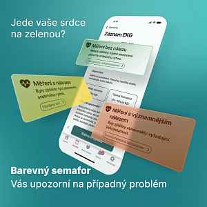 KARDI AI 12 měsíční EKG monitoring srdce XS-S